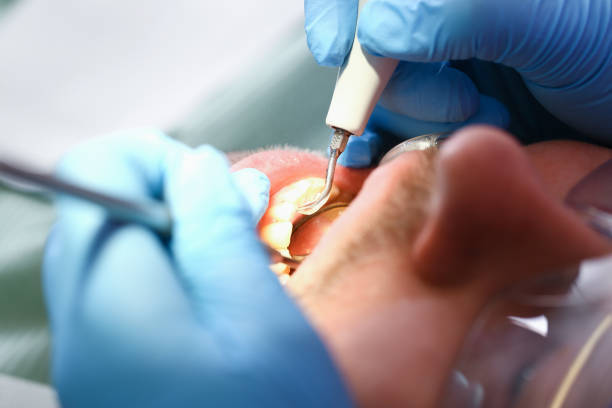 Best Knocked-Out Tooth Emergency  in Paris, TN