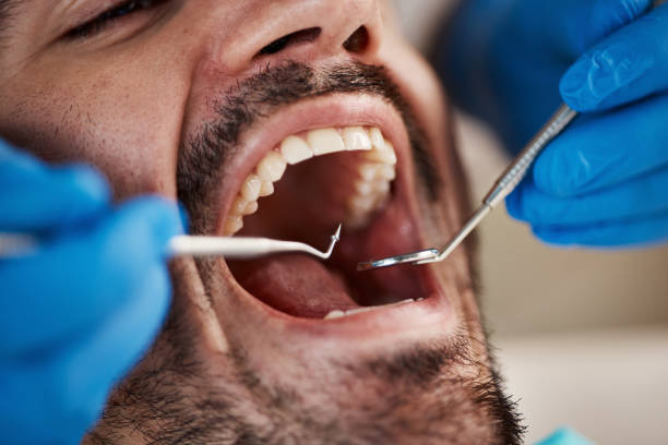 Best Urgent Tooth Repair  in Paris, TN