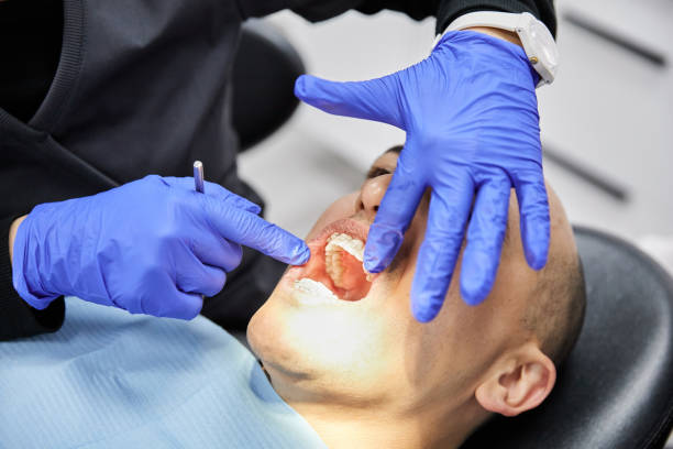 Emergency Dental Filling Replacement in TN
